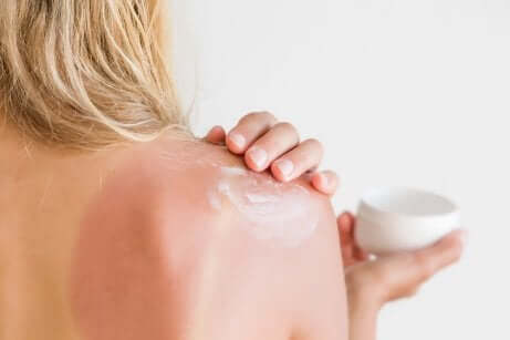 Lozioni doposole per prevenire le scottature solari.