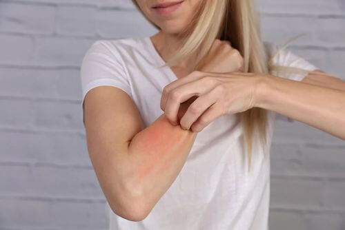 Dermatite da allergia che causa un'eruzione cutanea.