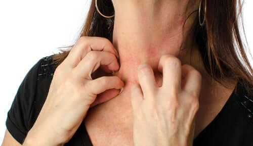 Donna che si gratta il collo.