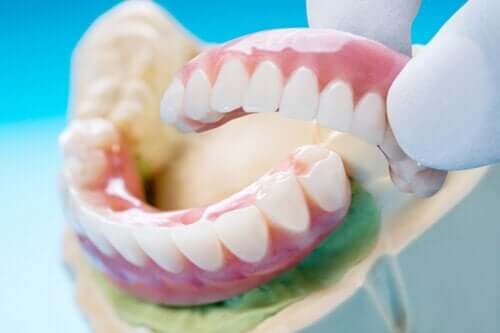 Ponte dentale: tipi, vantaggi e svantaggi