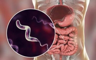 Infezioni da Campylobacter: cosa sapere