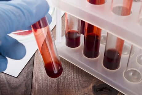 Mano con guanto di lattice e provette di sangue.