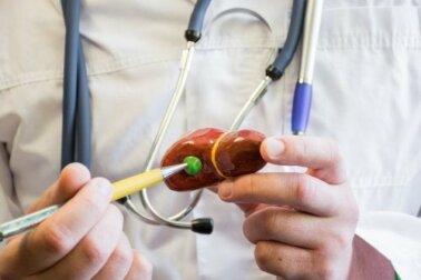 Litiasi biliare e nutrizione: che cosa bisogna sapere?