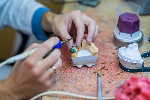 Ponte dentale in laboratorio.