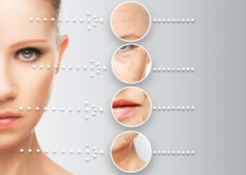 Punti critici dell'invecchiamento della pelle su viso femminile.
