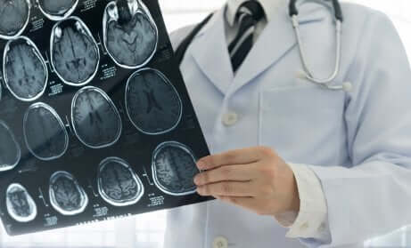 Trauma cranio-encefalico: radiografie alla testa.