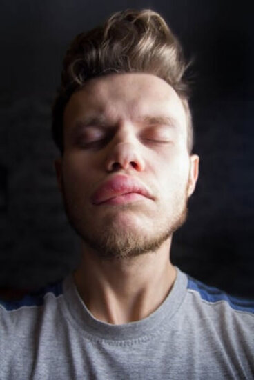 Edema di Quincke: cause e sintomi