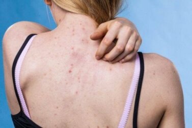Prevenire le malattie della pelle più comuni