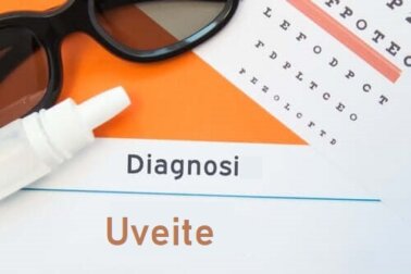 Uveite anteriore, intermedia e posteriore