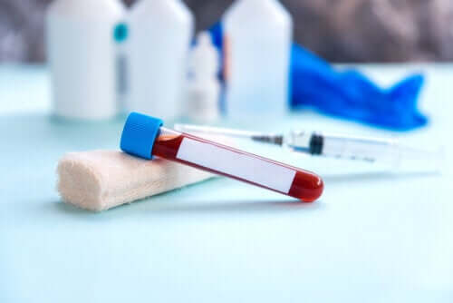 Velocità di eritrosedimentazione: in cosa consiste?