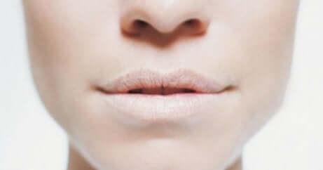 Viso femminile con labbra disidratate e anidrosi.