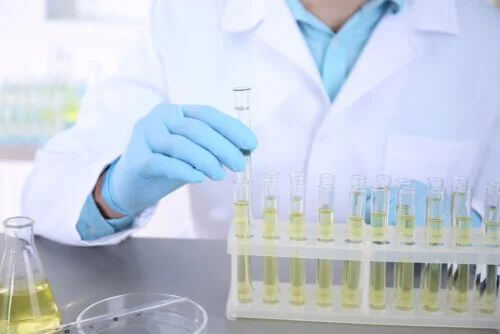 Urinocoltura: cos'è e a cosa serve?