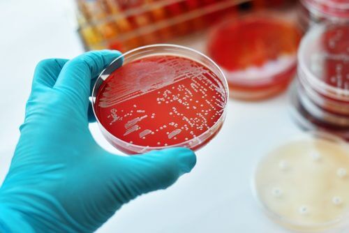 Coltura batterica per la diagnosi di sporotricosi.
