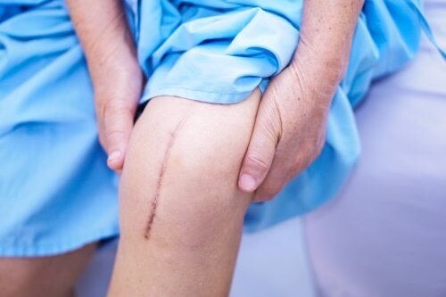 Cicatrizzazione della pelle: fasi e tipi