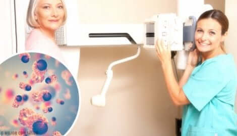 Recettore HER-2: esame mammografico.
