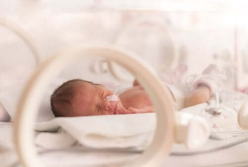 Neonato prematuro in incubatrice.