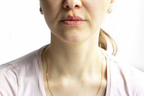 Ragazza con vesciche sulla bocca.