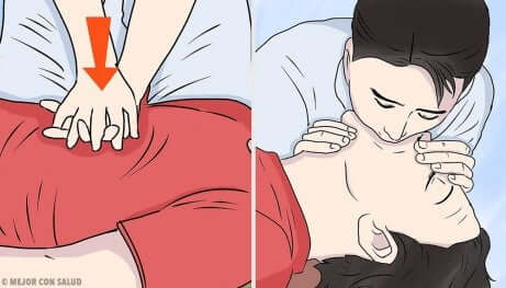 Rianimazione cardiopolmonare per congestione digestiva.