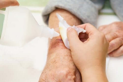 Ulcere da pressione: consigli e trattamento