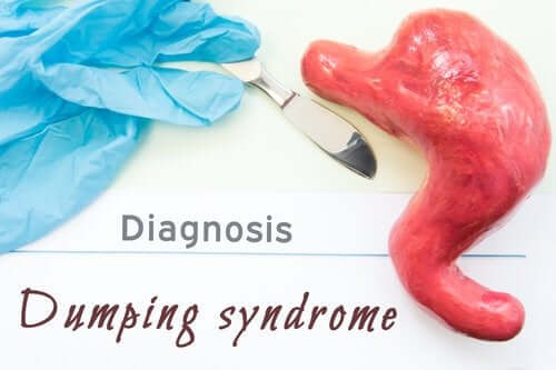 Sindrome da dumping.