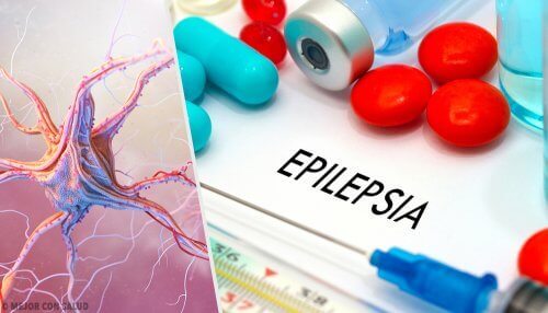 Epilessia.