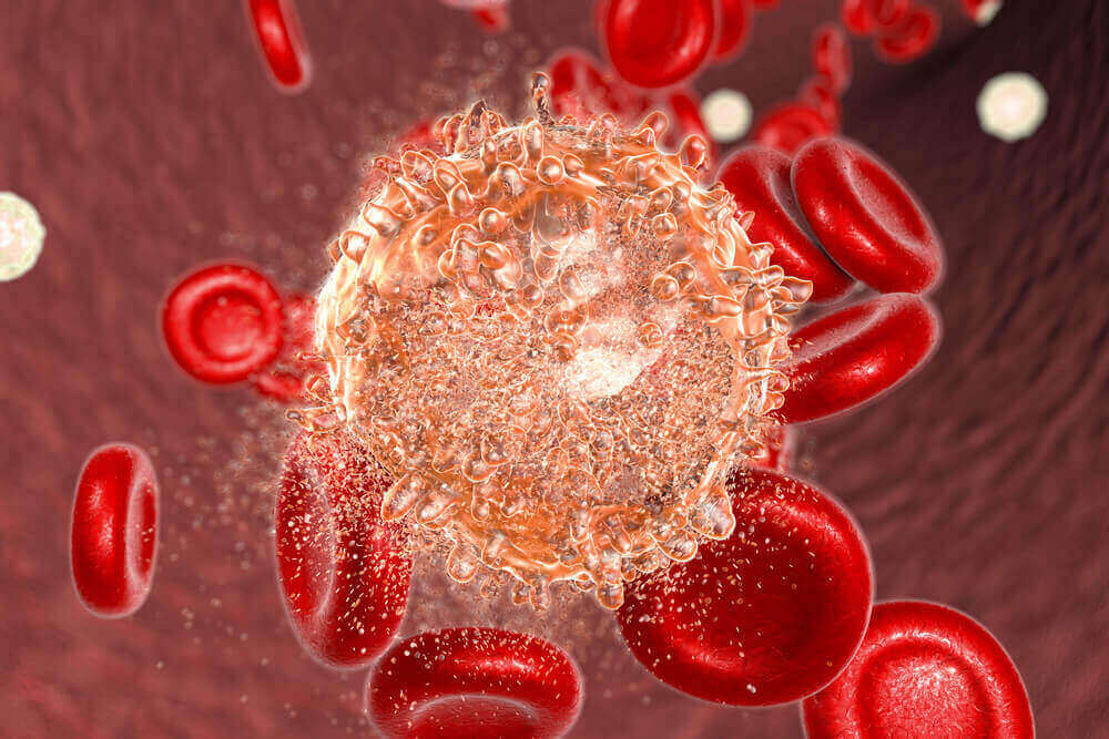 Malattie del sangue.