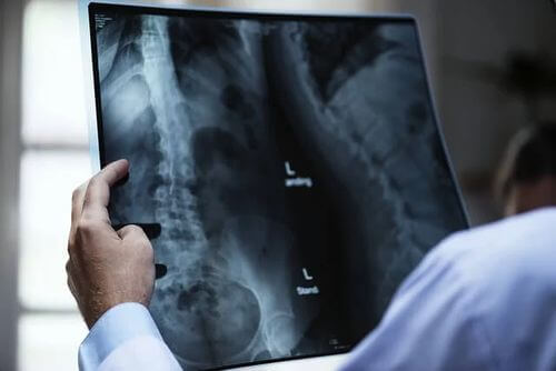 Medico analizza una radiografia.