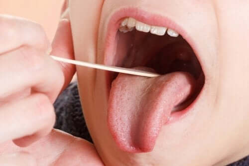 Le placche in gola: sintomi e cure