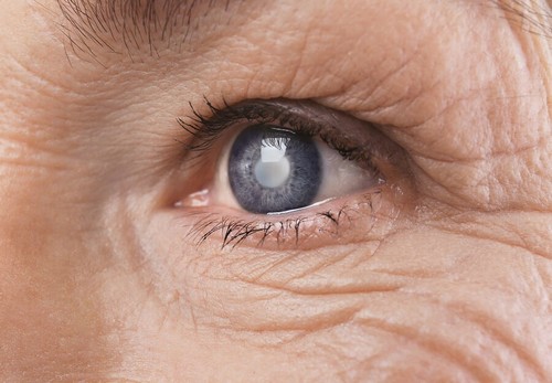 Retinopatia diabetica.