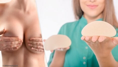 Seno e protesi mammarie.