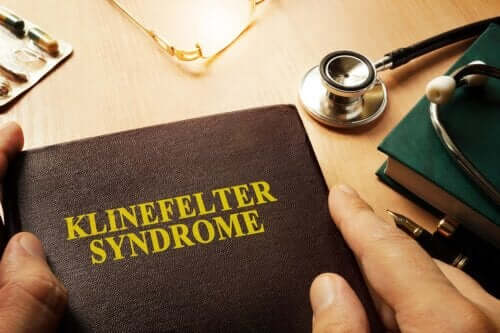 Sindrome di Klinefelter: definizione e sintomi