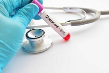 Valori normali di colesterolo: quali sono?