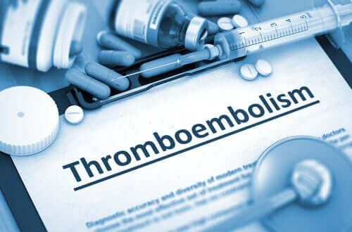 Tromboembolia: cause e fattori di rischio