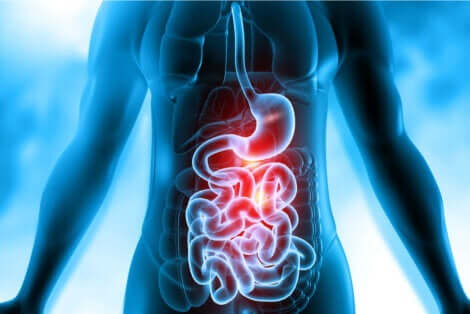 Le fistole gastrointestinali.