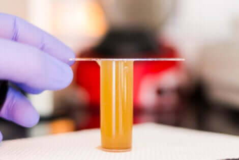 Campione per esame delle urine.