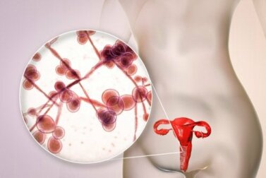 Ketoconazolo: indicazioni e controindicazioni