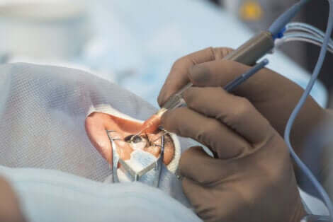 Intervento chirurgico dell'occhio.