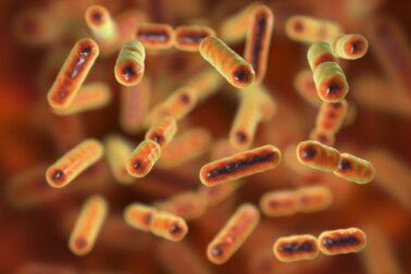 Disbiosi intestinale: di cosa si tratta?