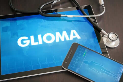 Glioma: definizione, tipi e trattamento