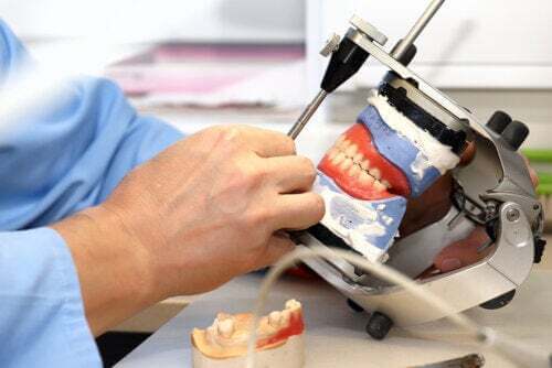 Protesi su impianti dentali: cosa sono?