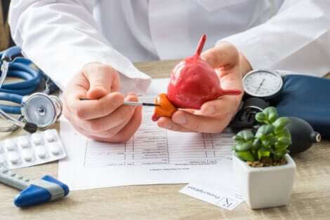 Medico con modellino della prostata.