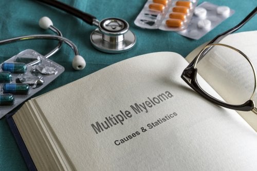 Mieloma multiplo: definizione, sintomi e trattamenti