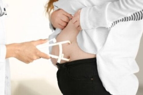 Donna con disbiosi intestinale.