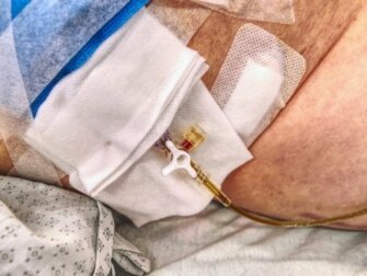 Stomia: consigli per condurre una vita normale