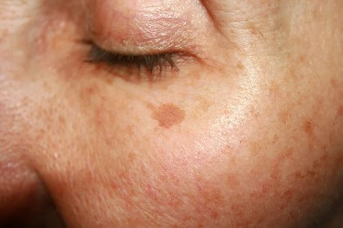 Creme antietà per ridurre le macchie della pelle del viso