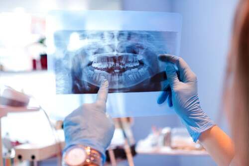 Radiografia dei denti.