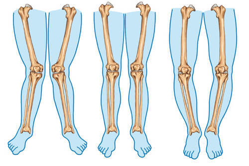 Tipi di gambe.
