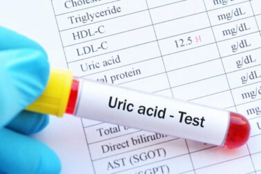 Iperuricemia: quali sono le conseguenze per la salute?