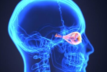 Neuromielite ottica o malattia di Devic: di cosa si tratta?
