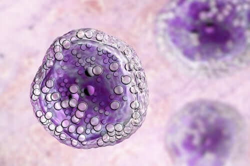 Cellule linfoma.